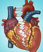 © SCIENCE SOURCE/GWEN SHOCKY/ MEDICAL IMAGES