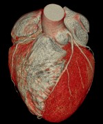 © RADIOLOGICAL IMAGING/ SHUTTERSTOCK.COM
